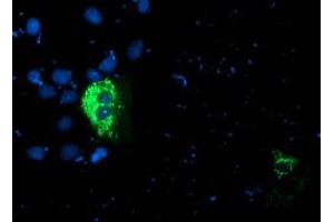 Anti-PDSS2 mouse monoclonal antibody (ABIN2455335) immunofluorescent staining of COS7 cells transiently transfected by pCMV6-ENTRY PDSS2 (RC207892). (PDSS2 抗体)