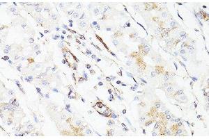 Immunohistochemistry of paraffin-embedded Human stomach using Vimentin Polyclonal Antibody at dilution of 1:150 (40x lens). (Vimentin 抗体)