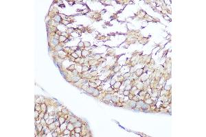Immunohistochemistry (IHC) image for anti-Inositol Polyphosphate-5-Phosphatase, 145kDa (INPP5D) (AA 959-1188) antibody (ABIN6213625)