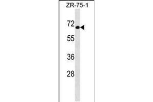 Western blot analysis in ZR-75-1 cell line lysates (35ug/lane). (GTF3C5 抗体  (AA 287-316))