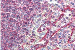 Human Spleen (formalin-fixed, paraffin-embedded) stained with HLA-E antibody ABIN364251 at 10 ug/ml followed by biotinylated anti-mouse IgG secondary antibody ABIN481714, alkaline phosphatase-streptavidin and chromogen. (HLA-E 抗体)
