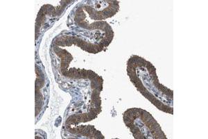 Immunohistochemical staining (Formalin-fixed paraffin-embedded sections) of human fallopian tube with DYRK1A polyclonal antibody  shows cytoplasmic positivity in glandular cells. (DYRK1A 抗体)