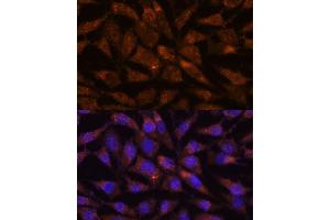 Immunofluorescence analysis of L929 cells using LM antibody (ABIN7268203) at dilution of 1:100. (LMAN2 抗体  (AA 190-320))
