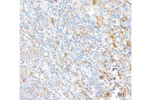 Immunohistochemistry (IHC) image for anti-Fc Fragment of IgG, Low Affinity IIIa, Receptor (CD16a) (FCGR3A) (AA 204-254) antibody (ABIN7449424)