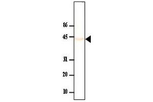 Western Blotting (WB) image for anti-Protein Phosphatase, Mg2+/Mn2+ Dependent, 1A (PPM1A) antibody (ABIN165454) (PPM1A 抗体)