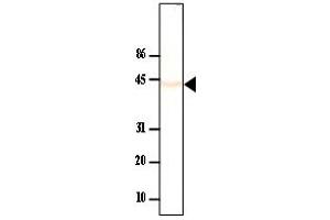 Western Blotting (WB) image for anti-Protein Phosphatase, Mg2+/Mn2+ Dependent, 1A (PPM1A) antibody (ABIN361111) (PPM1A 抗体)