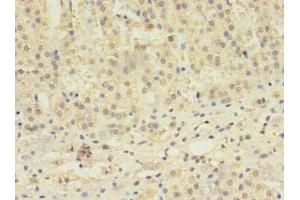 Immunohistochemistry of paraffin-embedded human adrenal gland tissue using ABIN7171610 at dilution of 1:100 (TBC1D2 抗体  (AA 1-237))