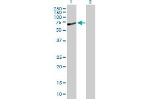 Western Blot analysis of SLC27A1 expression in transfected 293T cell line by SLC27A1 MaxPab polyclonal antibody. (SLC27A1 抗体  (AA 1-646))