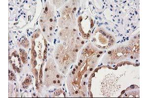 Immunohistochemical staining of paraffin-embedded Human Kidney tissue using anti-SULT1C2 mouse monoclonal antibody. (SULT1C2 抗体)