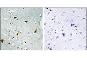 Immunohistochemistry analysis of paraffin-embedded human brain tissue, using STAT6 (Ab-641) Antibody. (STAT6 抗体  (AA 608-657))