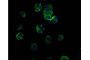 Immunofluorescence staining of MCF-7 cells with ABIN7172799 at 1:66, counter-stained with DAPI. (Transferrin Receptor 2 抗体  (AA 534-605))