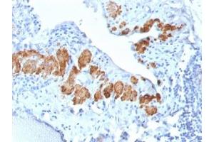 IHC testing of FFPE human breast tissue with recombinant SMMHC antibody (clone MYH11/2303R). (MYH11 抗体)