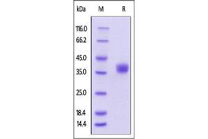 Human BTN1A1, His Tag on SDS-PAGE under reducing (R) condition. (BTN1A1 Protein (AA 27-242) (His tag))