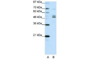 WB Suggested Anti-FOXA2  Antibody Titration: 0. (FOXA2 抗体  (C-Term))