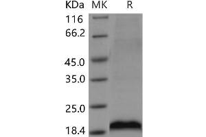 Western Blotting (WB) image for Mesencephalic Astrocyte-Derived Neurotrophic Factor (MANF) protein (His tag) (ABIN7320099)