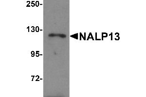 Western Blotting (WB) image for anti-NLR Family, Pyrin Domain Containing 13 (NLRP13) (N-Term) antibody (ABIN1031468)