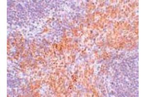 Immunohistochemical staining of mouse kidney tissue with 2. (RIPK1 抗体  (N-Term))