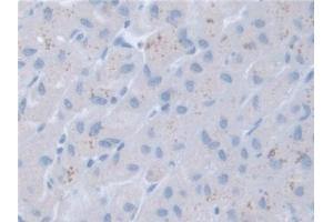 Immunohistochemistry (IHC) image for anti-Retinoic Acid Receptor, alpha (RARA) (AA 68-173) antibody (ABIN7432958)