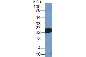 Detection of TNNI2 in Mouse Skeletal muscle lysate using Polyclonal Antibody to Troponin I Type 2, Fast Skeletal (TNNI2) (TNNI2 抗体  (AA 1-182))