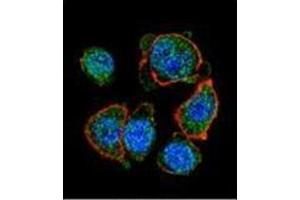 Confocal immunofluorescent analysis of  MITF Antibody (N-term) Cat. (MITF 抗体  (N-Term))