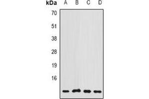 Western blot analysis of COX7A2L expression in MCF7 (A), A549 (B), Hela (C), mouse brain (D) whole cell lysates. (COX7A2L 抗体)
