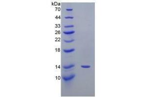 SDS-PAGE (SDS) image for Prostaglandin-Endoperoxide Synthase 2 (Prostaglandin G/H Synthase and Cyclooxygenase) (PTGS2) protein (ABIN3011318)