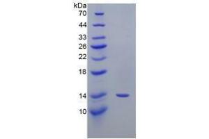 SDS-PAGE analysis of Mouse PTGS2 Protein. (PTGS2 蛋白)