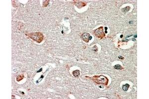 Immunohistochemistry (IHC) image for anti-gamma-aminobutyric Acid (GABA) A Receptor, beta 3 (GABRB3) (Internal Region) antibody (ABIN334404)