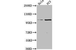 Western Blot Positive WB detected in: Hela whole cell lysate, PC3 whole cell lysate All lanes: PKN3 antibody at 1:2000 Secondary Goat polyclonal to rabbit IgG at 1/50000 dilution Predicted band size: 100 kDa Observed band size: 100 kDa (PKN3 抗体  (AA 1-252))