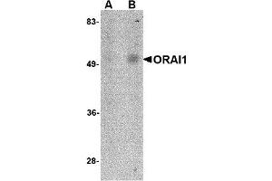 Western Blotting (WB) image for anti-ORAI Calcium Release-Activated Calcium Modulator 1 (ORAI1) antibody (ABIN1031712) (ORAI1 抗体)