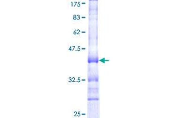PRSS1 Protein (AA 138-247) (GST tag)