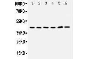 Anti-TRAM1 antibody, Western blotting Lane 1: Rat Brain Tissue Lysate Lane 2: Rat Kidney Tissue Lysate Lane 3: 293T Cell Lysate Lane 4: RAJI Cell Lysate Lane 5: JURKAT Cell Lysate (TRAM1 抗体  (C-Term))