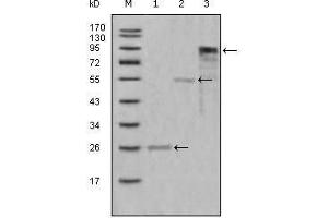 Western Blot showing MPO antibody used against truncated Trx-MPO recombinant protein (1),truncated MBP-MPO (aa1-193) recombinant protein (2) and truncated MPO (aa165-745)-hIgGFc transfected CHO-K1 cell lysate (3). (Myeloperoxidase 抗体  (AA 1-193))