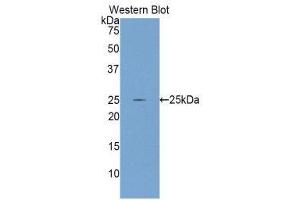 Western Blotting (WB) image for anti-Glutamate-Cysteine Ligase, Catalytic Subunit (GCLC) (AA 435-636) antibody (ABIN1858972) (GCLC 抗体  (AA 435-636))
