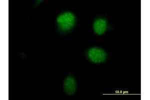 Immunofluorescence of purified MaxPab antibody to PHTF1 on HeLa cell.