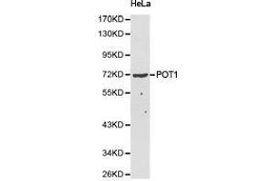 Western Blotting (WB) image for anti-Protection of Telomeres 1 (POT1) antibody (ABIN2650945) (POT1 抗体)