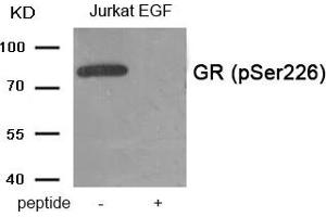 Western blot analysis of extracts from Jurkat cells treated with EGF using Phospho-GR (Ser226) antibody. (Glucocorticoid Receptor 抗体  (pSer226))