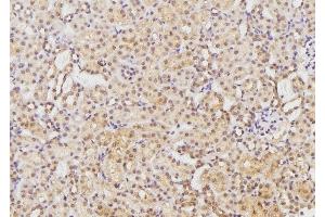 ABIN6261453 and ABIN6269282 at 1/100 staining Rat kidney tissue by IHC-P. (EFNB1/2 (C-Term) 抗体)