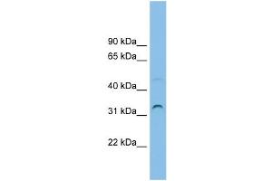 WB Suggested Anti-SECTM1 Antibody Titration: 0. (SECTM1 抗体  (Middle Region))