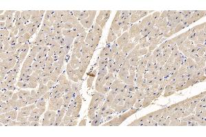 Detection of MYH4 in Human Cardiac Muscle Tissue using Monoclonal Antibody to Myosin Heavy Chain 4, Skeletal Muscle (MYH4) (MYH4 抗体  (AA 1633-1875))