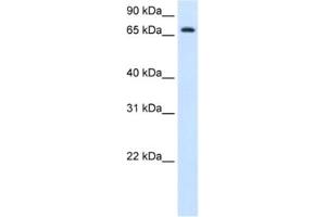Western Blotting (WB) image for anti-Histidine Ammonia-Lyase (HAL) antibody (ABIN2462882) (HAL 抗体)