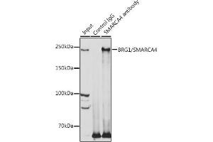 Immunoprecipitation (IP) image for anti-SWI/SNF Related, Matrix Associated, Actin Dependent Regulator of Chromatin, Subfamily A, Member 4 (SMARCA4) (AA 30-130) antibody (ABIN3022959)