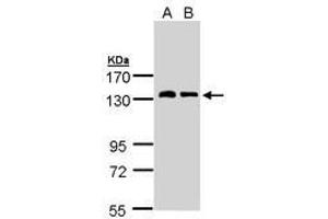 Image no. 1 for anti-Natriuretic Peptide Receptor A/guanylate Cyclase A (Atrionatriuretic Peptide Receptor A) (NPR1) (AA 640-886) antibody (ABIN467522) (NPR1 抗体  (AA 640-886))