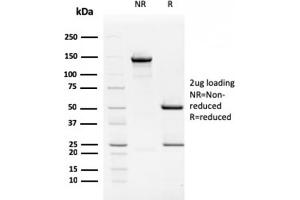 SDS-PAGE Analysis Purified TIM3 Mouse Monoclonal Antibody (TIM3/2399). (TIM3 抗体  (AA 22-202))