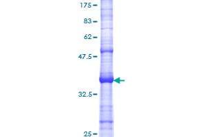 Asparagine Synthetase Protein (ASNS) (AA 281-380) (GST tag)