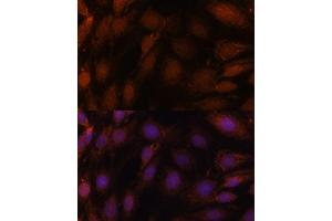 Immunofluorescence analysis of C6 cells using GCAT antibody (ABIN7267461) at dilution of 1:100. (GCAT 抗体  (AA 170-419))
