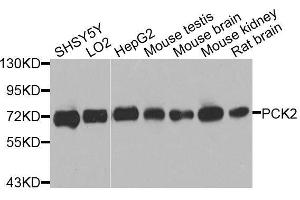 Western blot analysis of extracts of various cell lines, using PCK2 antibody. (PEPCK 抗体  (AA 1-280))