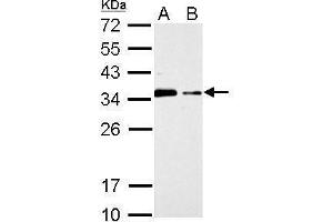 Western Blotting (WB) image for anti-Cytokine Inducible SH2-Containing Protein (CISH) (C-Term) antibody (ABIN2854656)