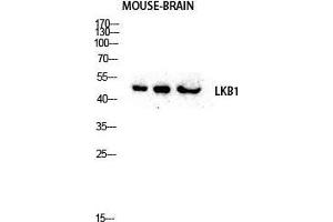 Western Blot (WB) analysis of Mouse Brain lysis using LKB1 antibody. (LKB1 抗体  (Tyr1313))