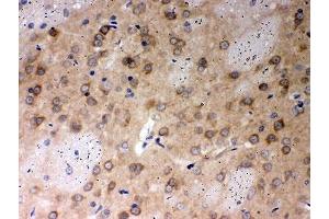 Immunohistochemistry (IHC) image for anti-Protein Phosphatase 2A Activator, Regulatory Subunit 4 (PPP2R4) (AA 1-309) antibody (ABIN3032389)